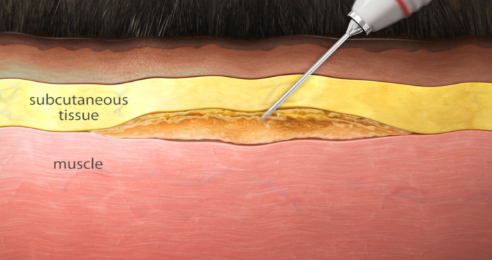 Animal Health Injection 3D Animal Health Injection 3D