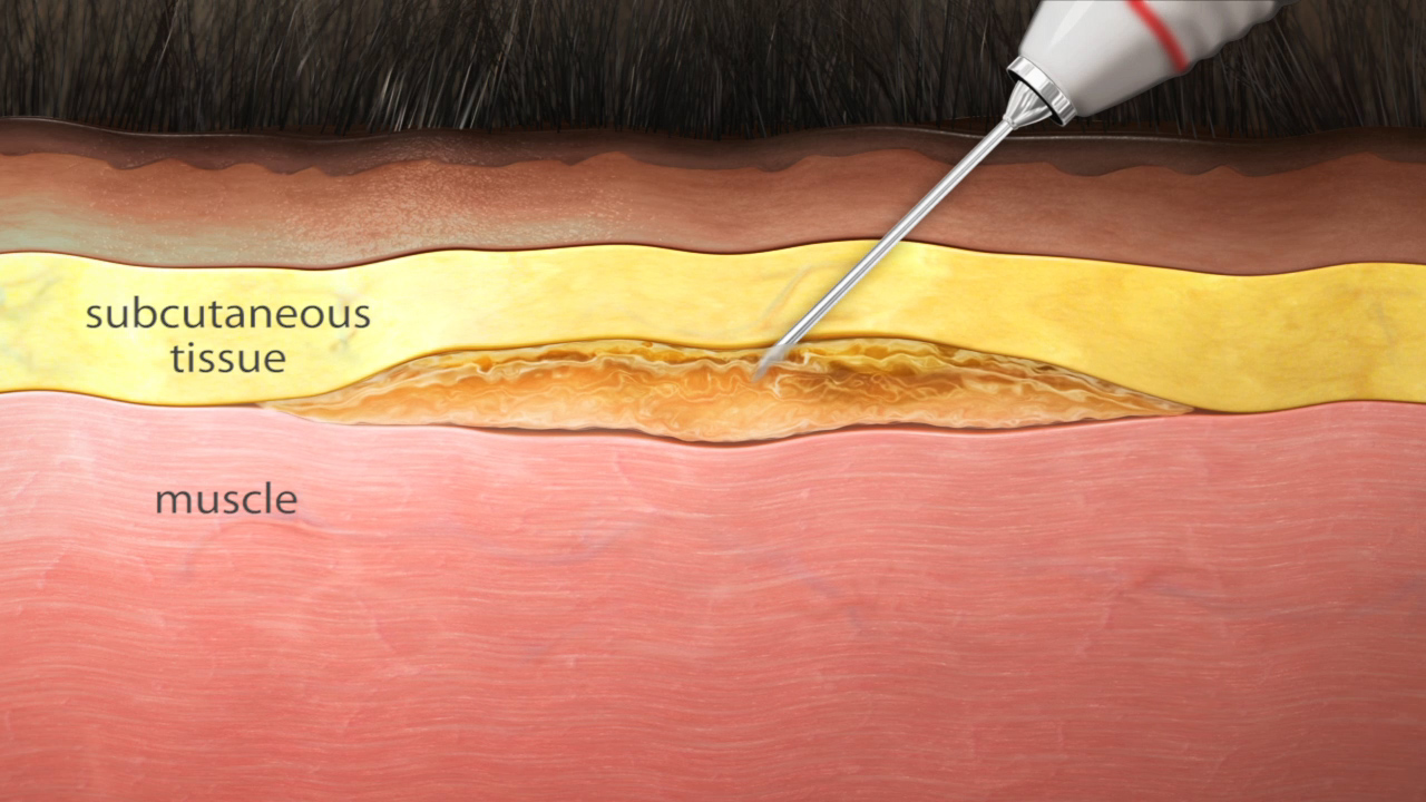 Animal Health Injection 3D Animal Health Injection 3D