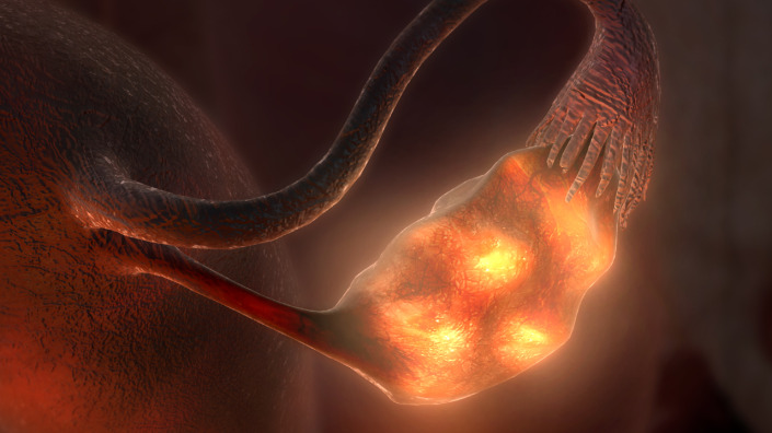 Project Assisted Reproduction Assisted Reproduction