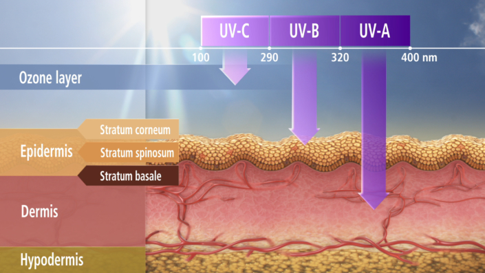 Non-Melanoma Skin Cancer