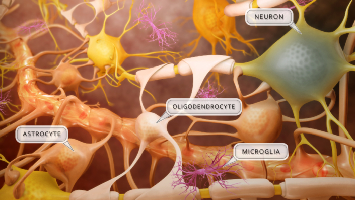 Post-stroke recovery