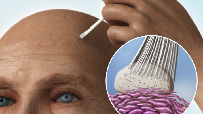 Project Spot-on Skin Treatment Spot-on Skin Treatment