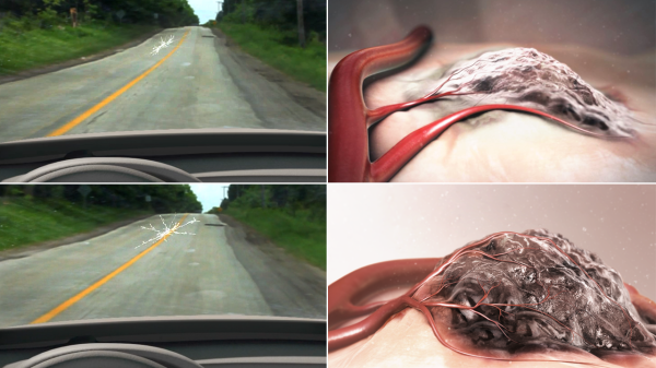 Cancerous vascular growth can be likened to a spreading crack in the windshield of a car.