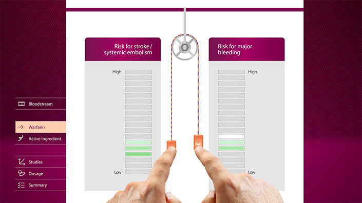 Stroke Prevention in Atrial Fibrillation