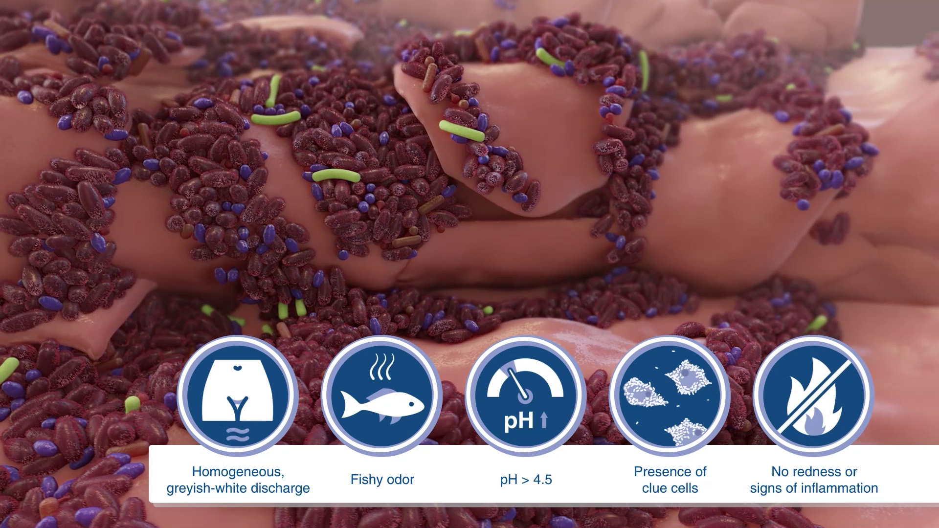 Medical animation and explainer videos - CAST PHARMA Medical animation and explainer videos - CAST PHARMA